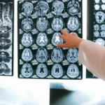 Казахстанцы могут получать услуги в частных клиниках по ОСМС — разъяснение фонда